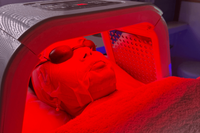Vampire Facial in Lucknow 